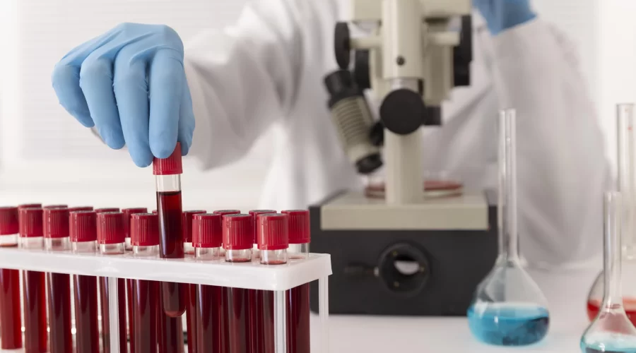coronavirus-blood-samples-arrangement-lab