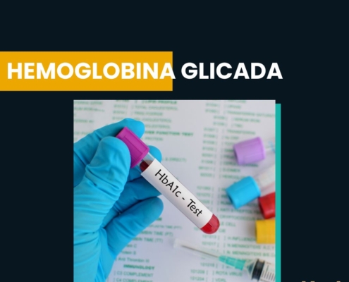 Hemoglobina glicada