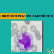 Linfócito reativo e monócito