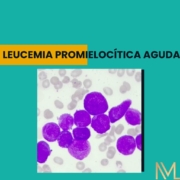 Leucemia Promielocítica Aguda