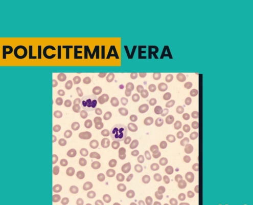 Policitemia Vera