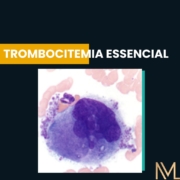 Trombocitemia essencial