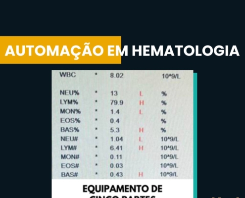 automação