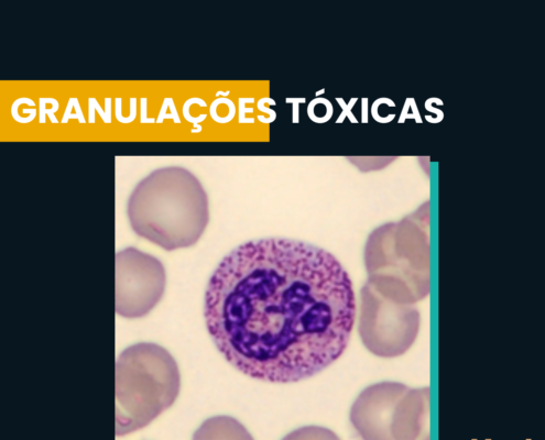 granulações tóxicas