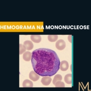 Hemograma na Mononucleose