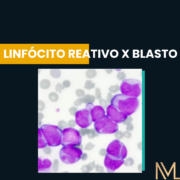 Linfócito reativo e blasto