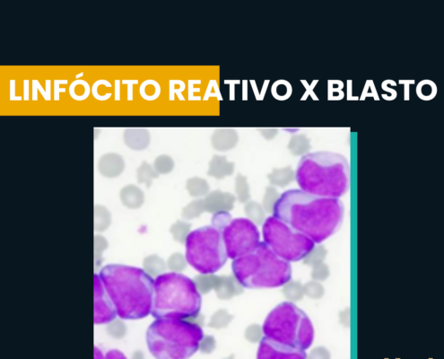 Linfócito reativo e blasto