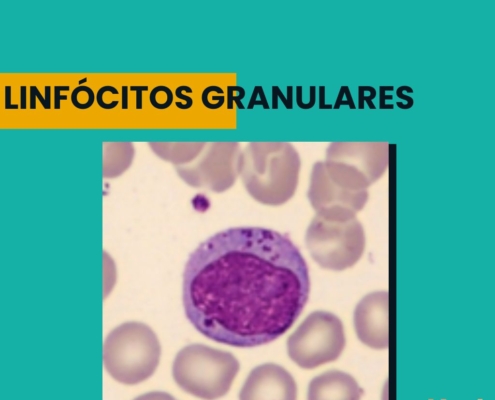 Linfócitos granulares