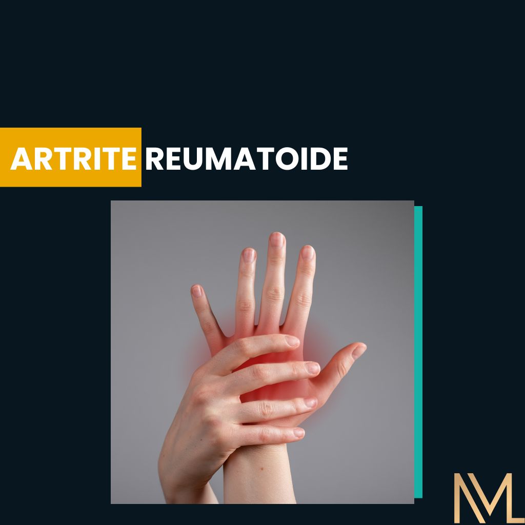 Artrite Reumatoide (AR): Uma Visão Clínica Abrangente - INML