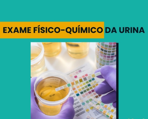 Exame físico químico da urina