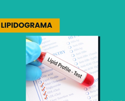 lipidograma