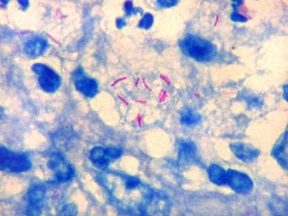 métodos de coloração em microbiologia