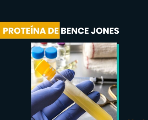 proteína de bence jones