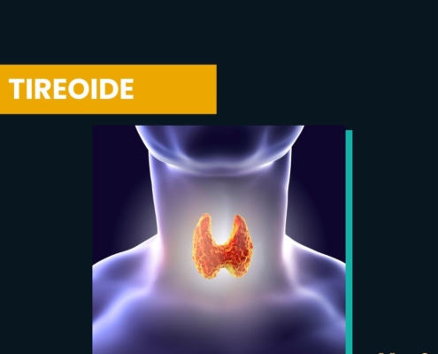 tireoide