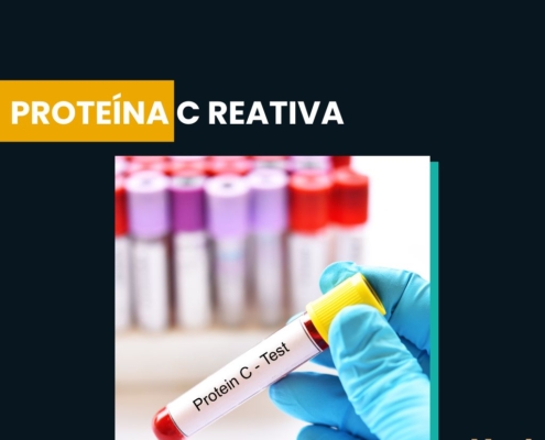 Proteína C Reativa