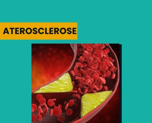 Aterosclerose