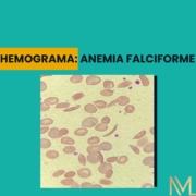 Hemograma na anemia falciforme