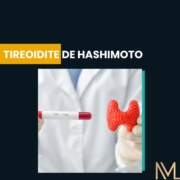 tireoidite de hashimoto