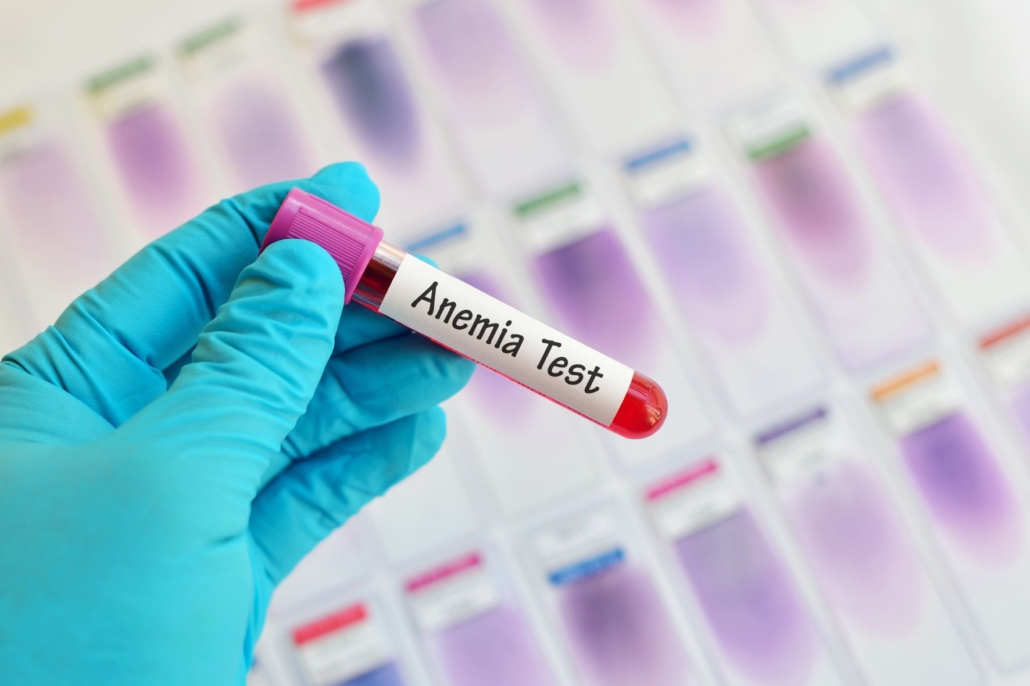 Anemia