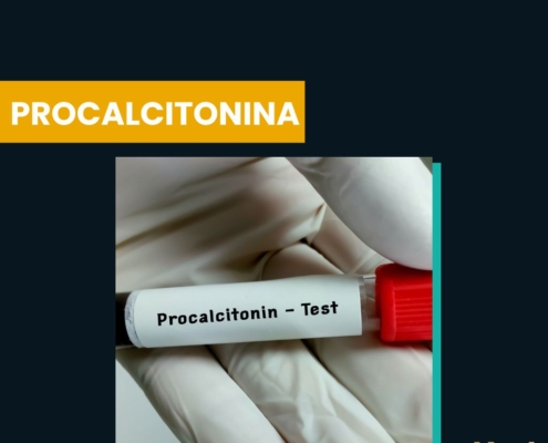 Procalcitonina