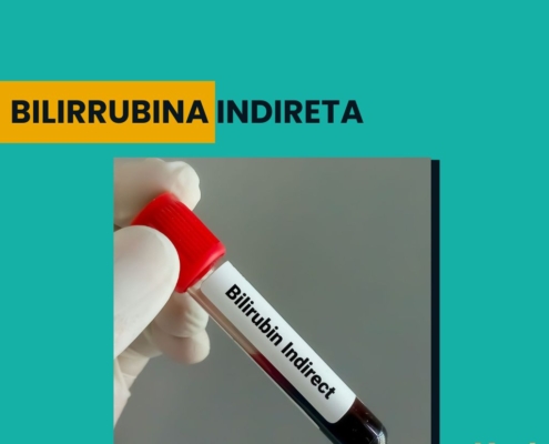 Bilirrubina Indireta