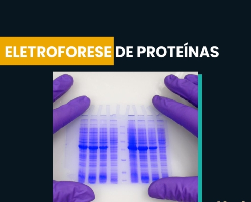 Eletroforese de Proteínas