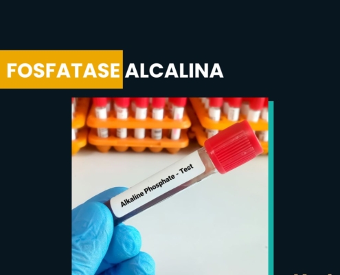 Fosfatase Alcalina