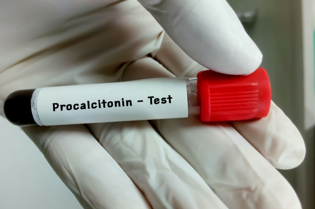 Procalcitonina