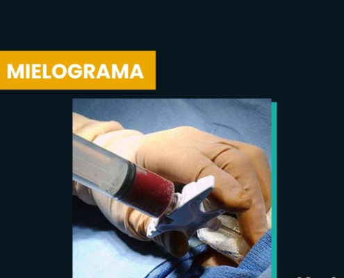 Mielograma