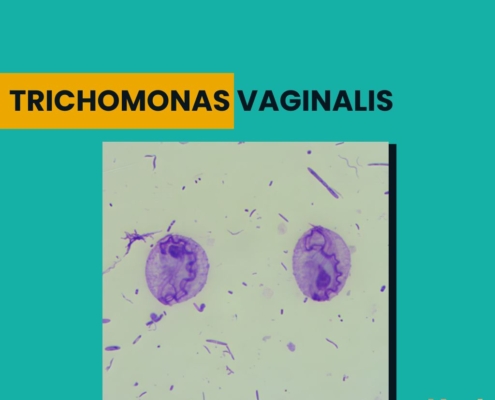 Trichomonas vaginalis