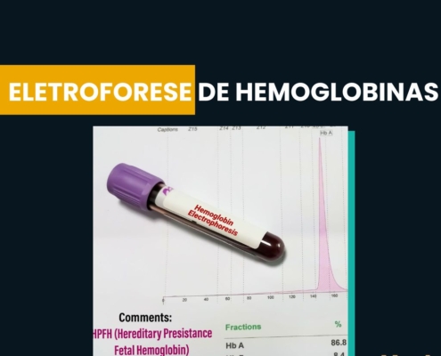 Eletroforese de Hemoglobinas