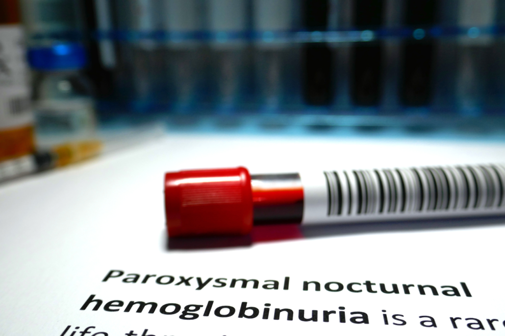 Hemoglobinúria Paroxística Noturna