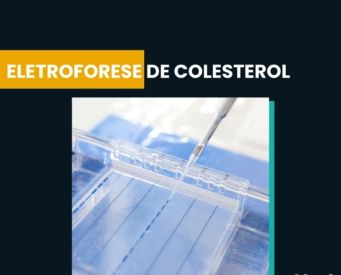 Eletroforese de Colesterol