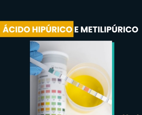 Ácido Hipúrico e Metilipúrico