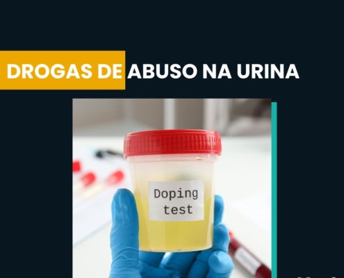 Drogas de Abuso na Urina