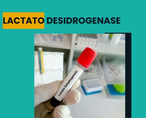 LACTATO DESIDROGENASE