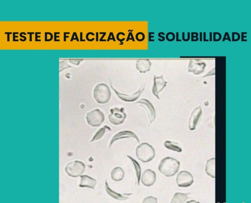 TESTE DE FALCIZAÇÃO E SOLUBILIDADE