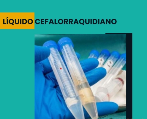 LIQUIDO CEFALORRAQUIDIANO