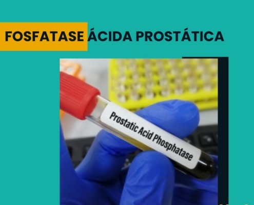Fosfatase ácida prostática