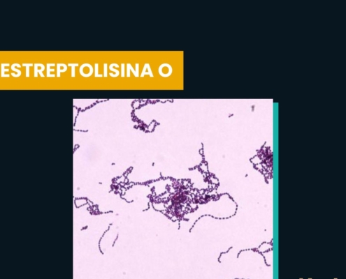 estreptolisina O
