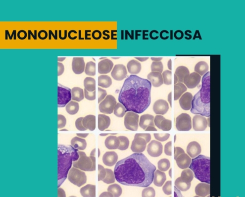 mononucleose infecciosa