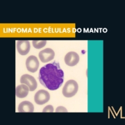 LINFOMA DE CÉLULAS DO MANTO