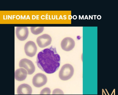 LINFOMA DE CÉLULAS DO MANTO