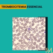 Trombocitemia essencial