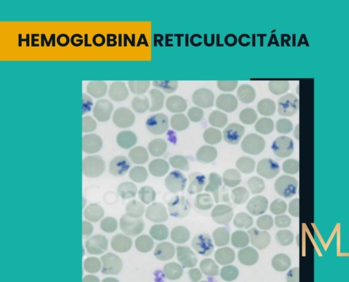 HEMOGLOBINA RETICULOCITÁRIA