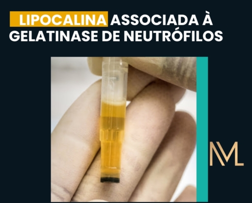 lipocalina