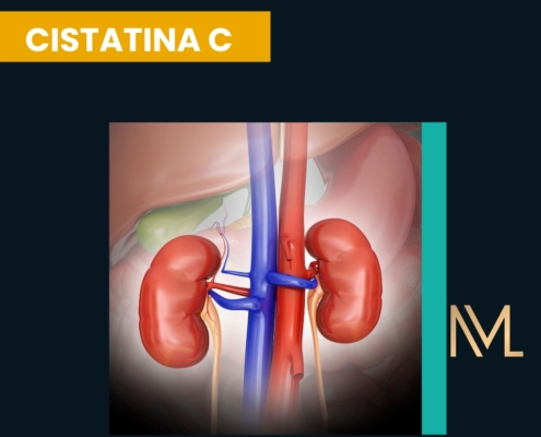 cistatina C