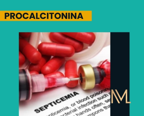 PROCALCITONINA