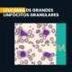 leucemia de grandes linfócitos granulares