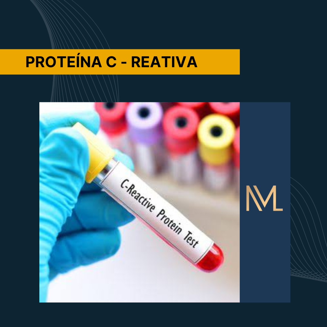 Proteína C-Reativa (PCR) - INML